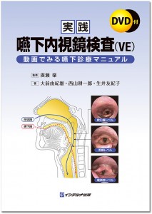 経鼻内視鏡マニュアル―カラー写真とDVDでわかる