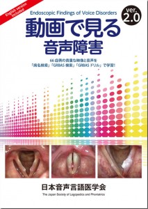 動画で見る音声障害（Endoscopic Findings of Voice Disorders）ver